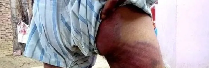 बंडा पुलिस ने युवक को बेरहमी से पीटा