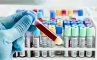 मुख्यमंत्री पोर्टल पर अवैध पैथोलॉजी की शिकायत, कार्रवाई की मांग