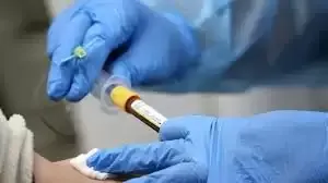 कोरोना महामारी में नर्सों ने स्वास्थ्य सेवाओं को दिया अतुलनीय योगदान ​​​​​​​