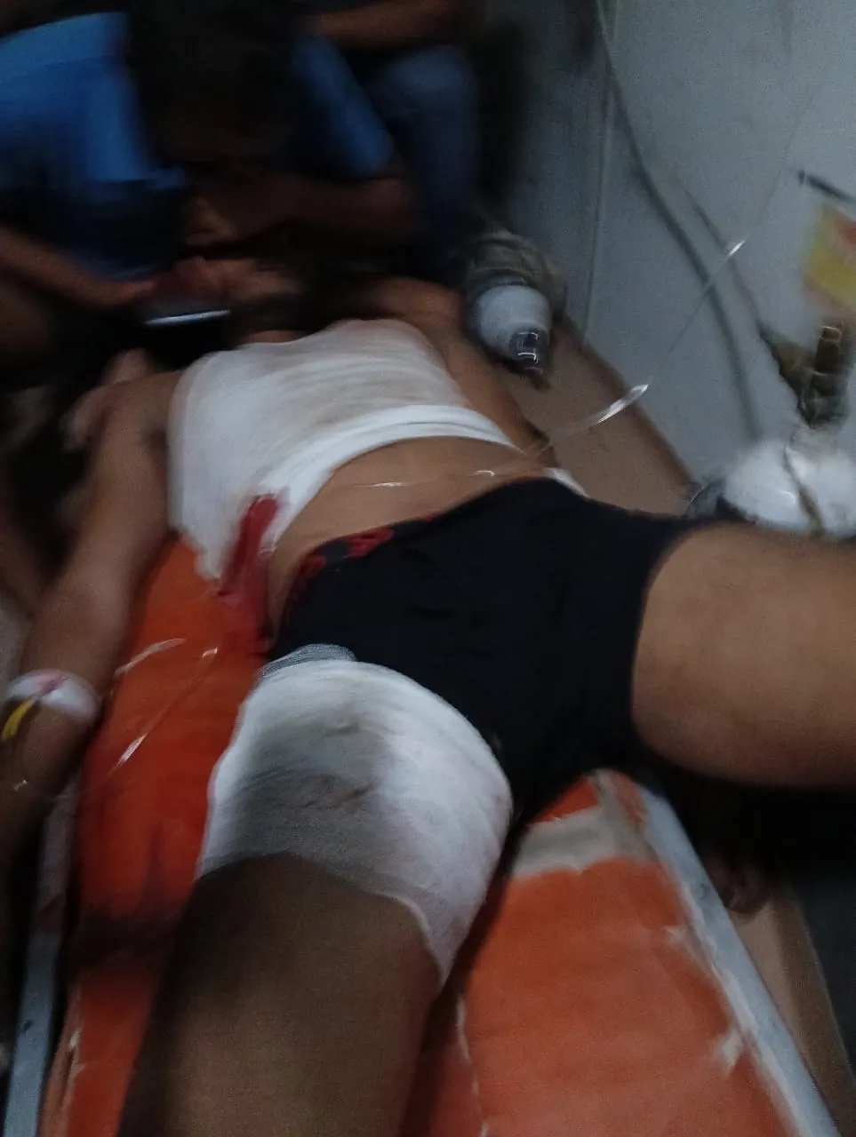 सिकरीगंज क्षेत्र अहिरौली खूर्द में दबंगो ने मारी गोली, इलाज के दौरान हुई मौत