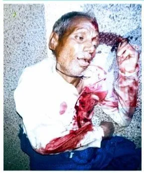 अज्ञात वाहन की चपेट में आने से वृद्ध व्यक्ति हुआ गंभीर रूप से घायल