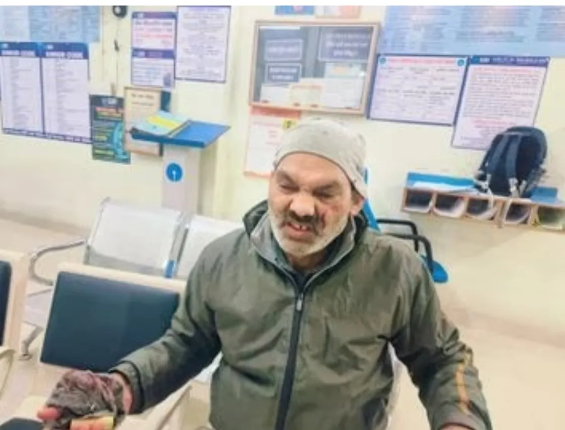 स्टेट बैंक पतारा के कर्मचारियों पर हथियार से बदमाश का हमला 