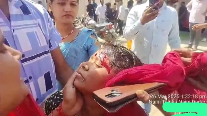 अरेल नैनी में मरीज के परिजन के साथ मारपीट में महिला घायल।अस्पताल के खिलाफ कारवाही मांग।