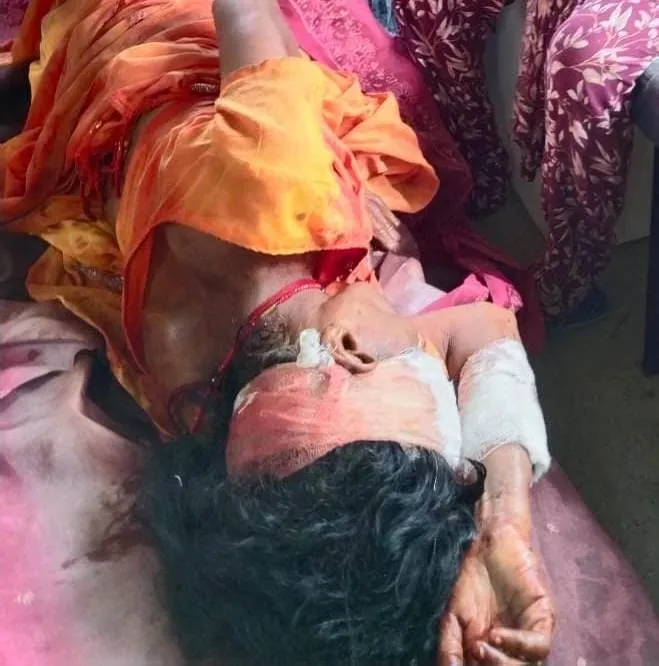 छोटी बहू ने सास को पीट कर किया लहूलुहान अस्पताल मैं चल रहा है इलाज