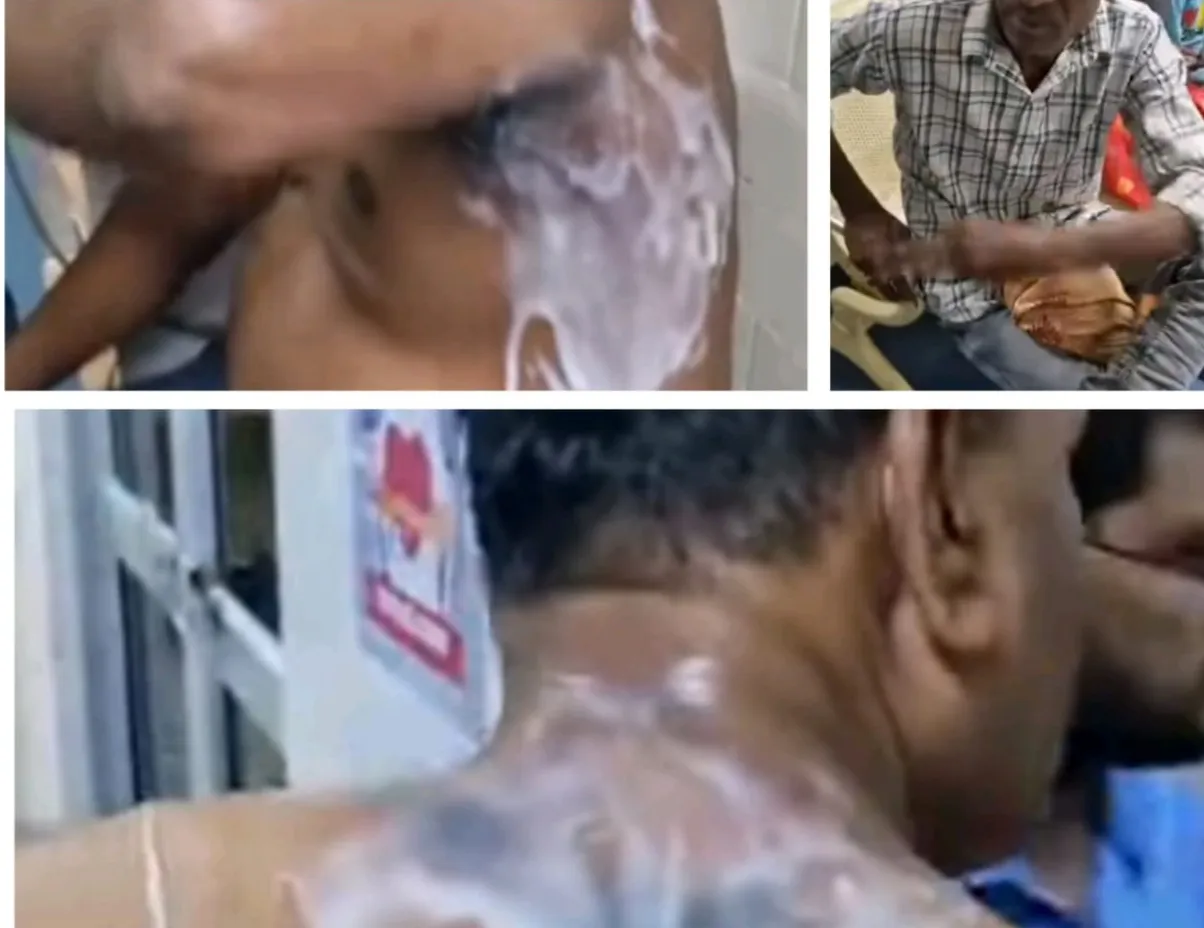 रेणुकूट रामलीला में रावण दहन के दौरान बड़ा हादसा आतिशबाजी दर्शकों के बीच गिरी, चार घायल