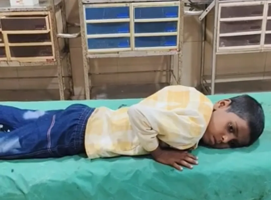 कुशीनगर : पागल कुत्ते ने राहगीरों पर किया हमला, कई लोग घायल