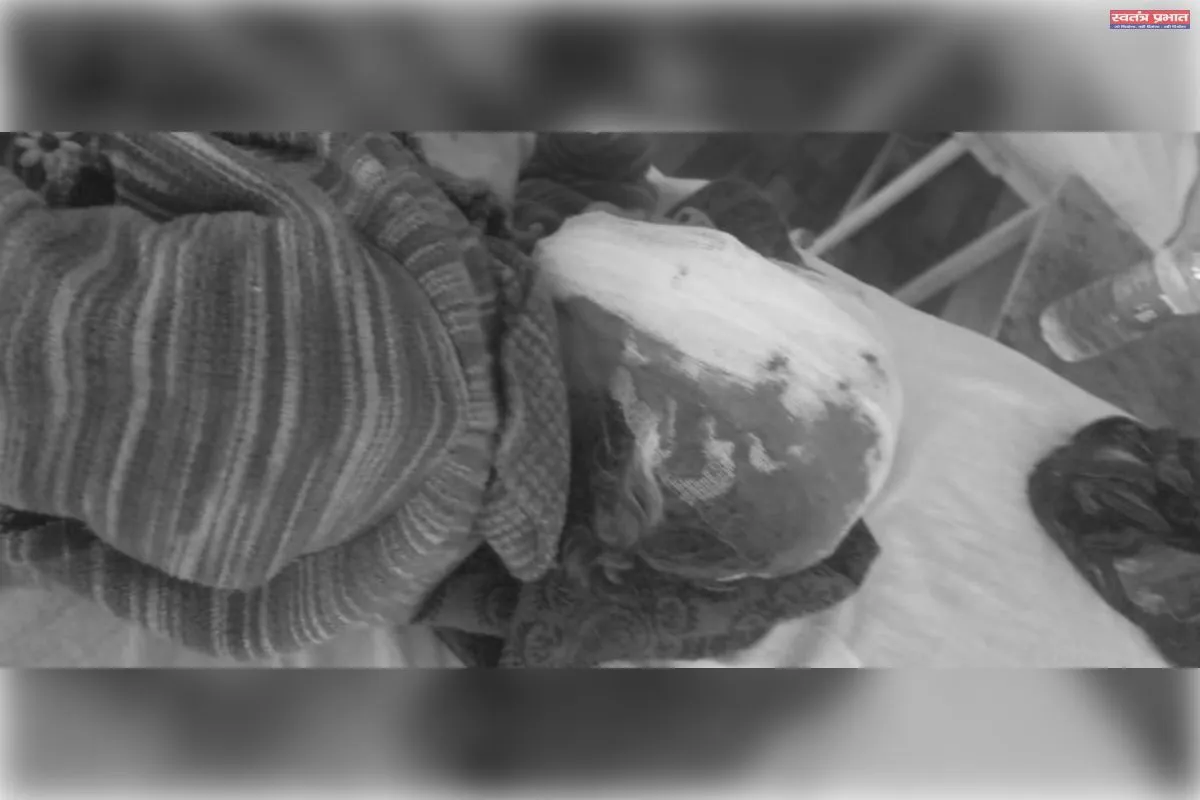 पुरानी रंजिश को लेकर हुए मारपीट में गंभीर चार घायल जिला अस्पताल रेफर दो की हालत नाजुक