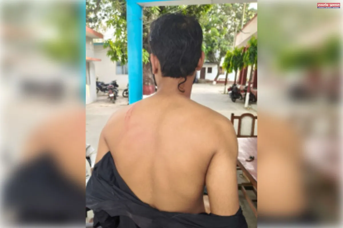 आपदा में अवसर! गैस एजेंसी पर ‘ब्लैक’ का खेल, विरोध करने पर युवक की पिटाई, 1200 रुपये भी छीने