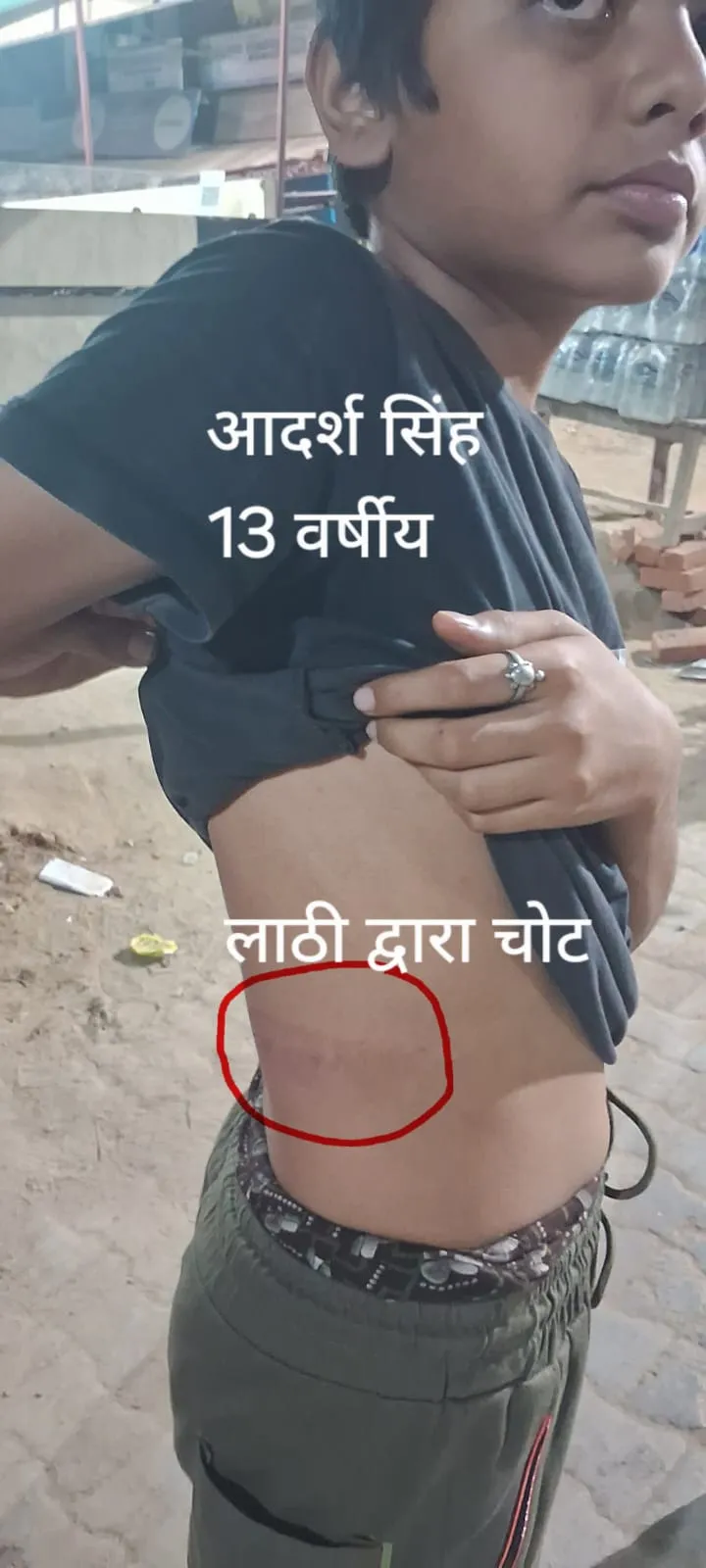 प्रतापगढ़ में दबंगों का खूनी खेल! घर पर हमला,&nbsp;बच्चों तक को नहीं बख्शा &mdash; पुलिस की निष्क्रियता पर बड़े सवाल