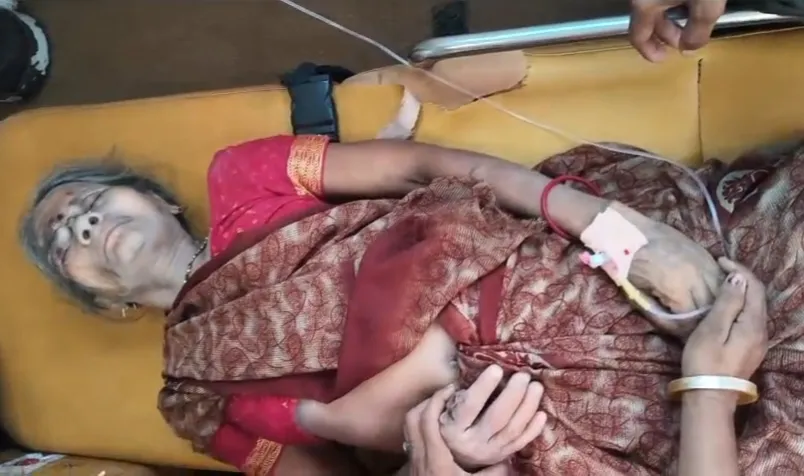 बिजली की टूटी तार की चपेट में आकर वृद्ध महिला गंभीर रूप से झुलसी