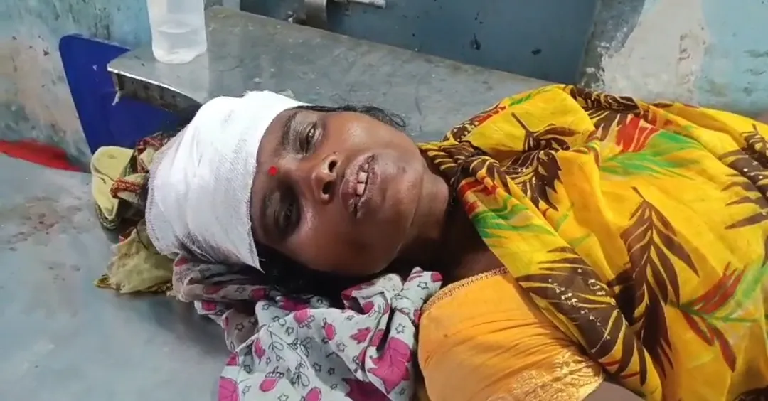 बंदरों के आतंक से ग्रामीणों में दहशत, महिला को छत से धक्का देकर किया घायल, छपरा रेफर 