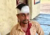 घर के सामने काम कर रहे युवक पर कार सवार पांच लोगों का हमला, सिर पर लोहे की रॉड से वार करने का आरोप; पीड़ित ने पुलिस से लगाई न्याय की गुहार