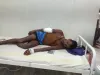 Bihar : मगरमच्छ के हमले में किसान घायल अनुमंडल अस्पताल में भर्ती