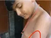 कुशीनगर : मासूम छात्र का कसूर इतना था बेंच की पेंट को खुरुच दिया,गुस्साए क्रूर संचालक ने शरीर का चमड़ी उधेड़ दिया