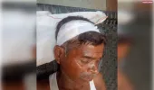 पशु चराकर लौट रहे व्यक्ति पर हमला