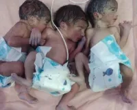 जिला अस्पताल में एक महिला ने एक साथ जन्में तीन बच्चे