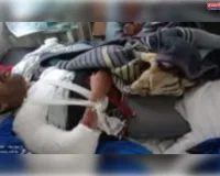 नौबस्ता में डंपर की टक्कर से महिला की मौत,पति गंभीर घायल