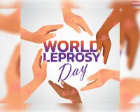 कुष्ठ रोग के खिलाफ सरकार की निर्णायक लड़ाई, जागरूकता, इलाज और सम्मान की ओर भारत