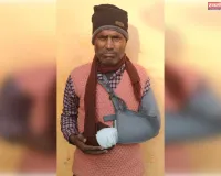 गलत इलाज से हुआ इंफेक्शन, हाथ कटवाने की नौबत मुख्यमंत्री को भेजी शिकायत