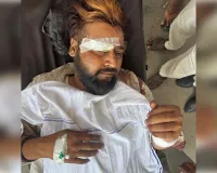 शताब्दी बस से बचने में कंटेनर हादसे का शिकार