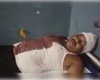  जिगना थाना क्षेत्र के बघेडा कला में दो पक्षों में जमकर मारपीट, कई गंभीर घायल 