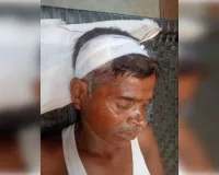 पशु चराकर लौट रहे व्यक्ति पर हमला
