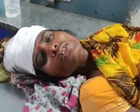 बंदरों के आतंक से ग्रामीणों में दहशत, महिला को छत से धक्का देकर किया घायल, छपरा रेफर 