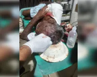 घर में घुसकर मारपीट का आरोप, दो घायल; बुजुर्ग के सिर में गंभीर चोट