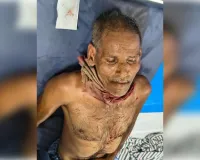 शराब के नशे में गाली-गलौज कर रहे बेटे को पिता ने डांटा, चाकू से गर्दन पर किया वार