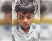 अचानक चली बारूद से किशोर की आँख जख्मी 