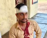 घर के सामने काम कर रहे युवक पर कार सवार पांच लोगों का हमला, सिर पर लोहे की रॉड से वार करने का आरोप; पीड़ित ने पुलिस से लगाई न्याय की गुहार