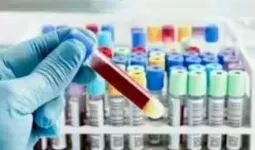 मुख्यमंत्री पोर्टल पर अवैध पैथोलॉजी की शिकायत, कार्रवाई की मांग