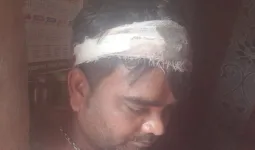 रहीमाबाद थाना क्षेत्र के ग्राम गोंदा मुआज्जमनगर में पुरानी रंजिश में हिंसक हमला