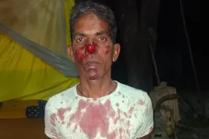 धारदार हथियार से अधेड़ की काठी नाक, अस्पताल में चल रहा है इलाज
