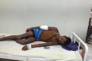 Bihar : मगरमच्छ के हमले में किसान घायल अनुमंडल अस्पताल में भर्ती