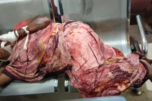  गोरखपुर में पाटीदारों ने हंसिया और गंडासे से मारकर किया महिला को लहूलुहान, हालत गंभीर