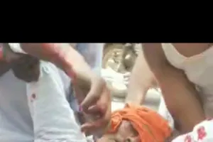 बाइक सवार और ऑटो में टक्कर युवक गंभीर रूप से घायल