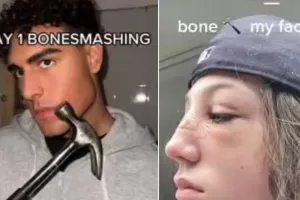 हथौड़े से चेहरे पर वार करने से खूबसूरती में लग जायेगा चारचांद, टिकटॉक पर वायरल हुआ विचित्र ट्रेंड 