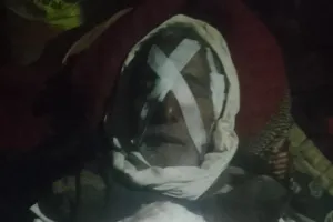 कुत्तों के झुंड ने मड़हे में बैठी महिला को नोच नोच कर सिर और हाथ खा गए_मौत