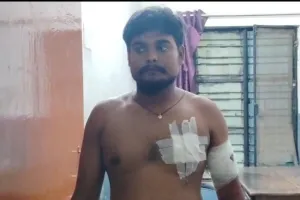 बाईक सवार बदमाशों ने ऑटो चालक को दौड़ा कर मारी गोली, कोतवाली से महज 200 मीटर की दूरी पर वारदात