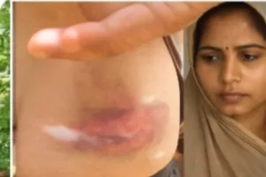  गोरखपुर: दबंगों की गुंडई से गांव में दहशत, गर्भवती पत्नी से कराई उठक-बैठक पति को पीटा, पुलिस 48 घंटे बाद भी खाली हाथ !