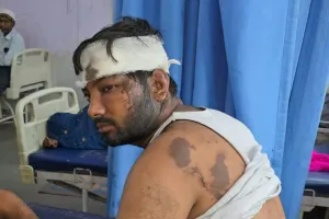 पति ने पत्नी और मायके वालों पर फेंका तेजाब दहेज के लिए कर रहा था प्रताड़ित, तीन घायल