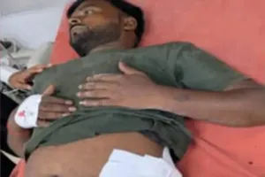 झलवा में फल विक्रेता पर ताबड़तोड़ फायरिंग, हालत नाजुक।