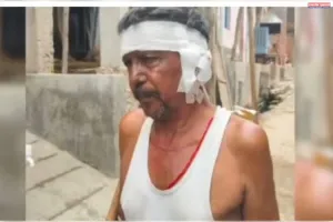 नारायण पुर में बंदरों का तांडव, हफ्ते भर में एक दर्जन लोग ज़ख्मी