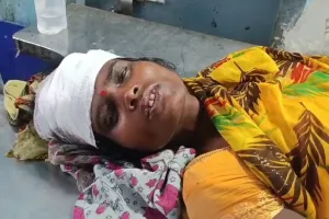 बंदरों के आतंक से ग्रामीणों में दहशत, महिला को छत से धक्का देकर किया घायल, छपरा रेफर 