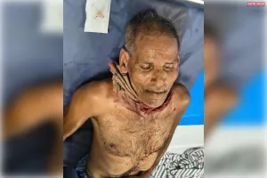 शराब के नशे में गाली-गलौज कर रहे बेटे को पिता ने डांटा, चाकू से गर्दन पर किया वार