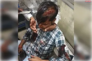 कचहरी जैसे संवेदनशील इलाके में पत्रकार पर हमला, पुलिस ने शुरू की आरोपियों की तलाश