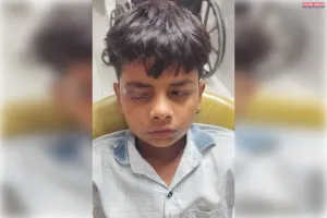 अचानक चली बारूद से किशोर की आँख जख्मी 