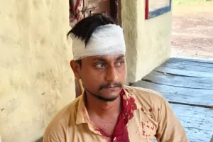 घर के सामने काम कर रहे युवक पर कार सवार पांच लोगों का हमला, सिर पर लोहे की रॉड से वार करने का आरोप; पीड़ित ने पुलिस से लगाई न्याय की गुहार